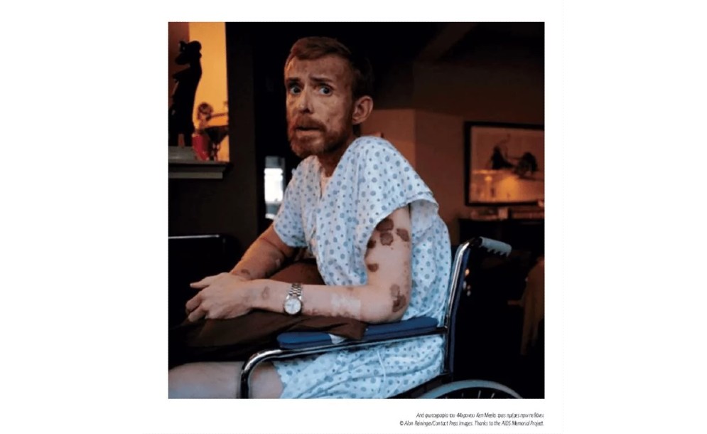 AIDS: Μια φωτογραφία σταθμός