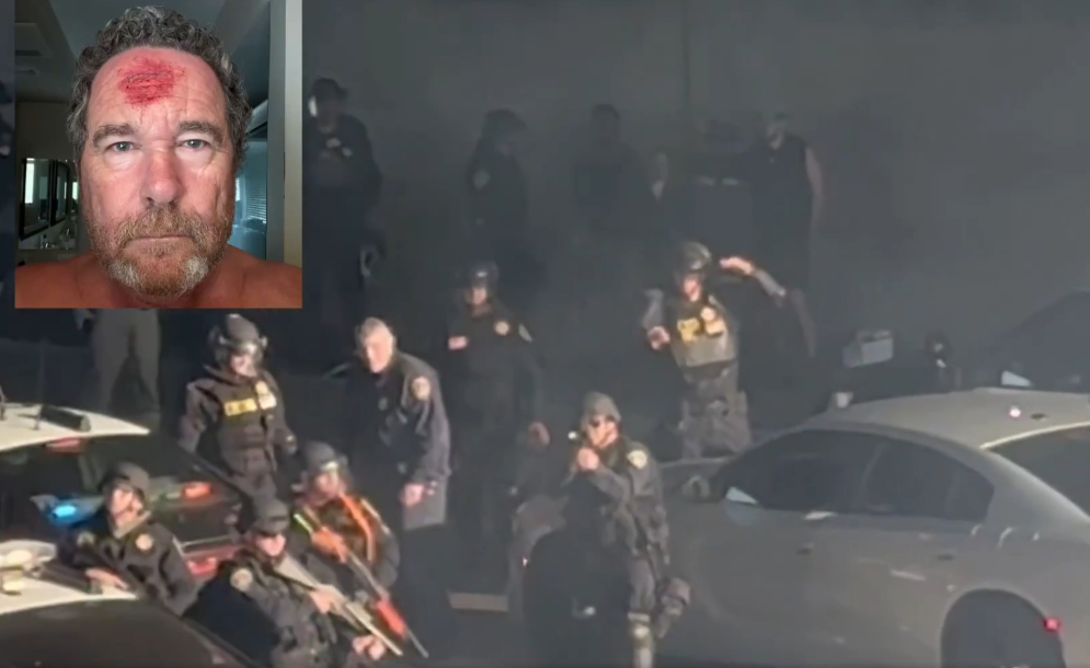 Λος Αντζελες: Αστυνομικός τραυμάτισε φωτογράφο με πλαστική σφαίρα